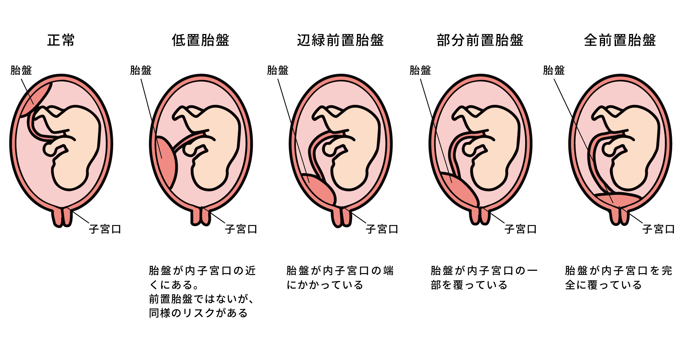 胎盤の画像